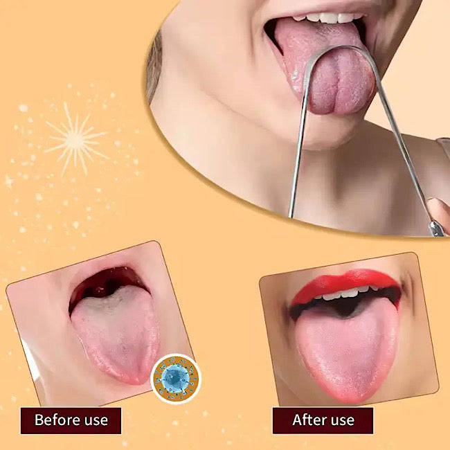 Nettoyage de langue en acier inoxydable